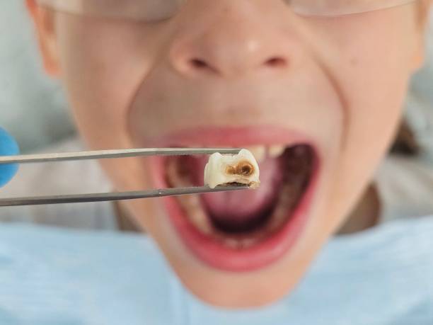 Best Emergency Dentist for Special Needs Patients in Fincastle, TN