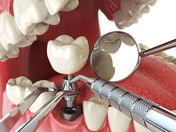 Best Emergency Cosmetic Dentistry in Fincastle, TN
