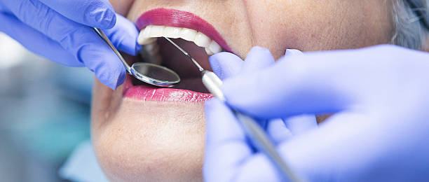 Best Emergency Dentist for Knocked-Out Tooth in Fincastle, TN